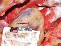Chinese woman with a stabbed heart