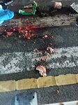 A man got into a car accident and his brain flew out