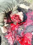 Photo collection from a Russian medic