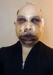 Finnish transgender blogger before and after plastic surgery