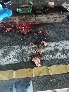A man got into a car accident and his brain flew out