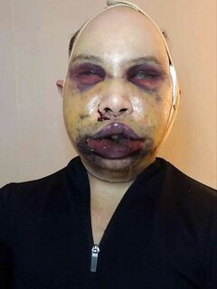 Finnish transgender blogger before and after plastic surgery
