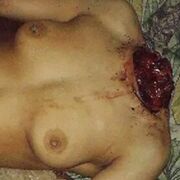 WARNiPPLES
