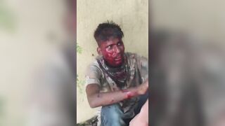 Migrant Worker Attacked By Youth With Machete
