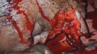 Man Hacked With Machete During A Drunk Fight In Brazil