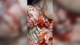 Man Hacked With Machete During A Drunk Fight In Brazil