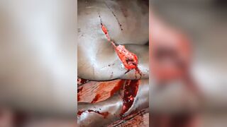 Man Hacked With Machete During A Drunk Fight In Brazil