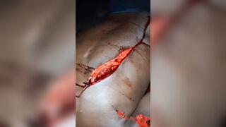 Man Hacked With Machete During A Drunk Fight In Brazil