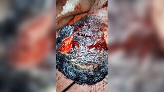 Man Hacked With Machete During A Drunk Fight In Brazil