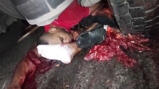 Motorcyclist Crushed by truck wheel