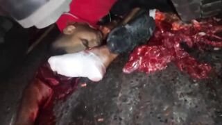 Motorcyclist Crushed by truck wheel