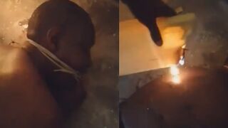 Kidnapped For Ransom Man Tortured With Molten Plastic