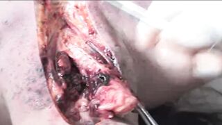 (DARK WEB) CHINESE DEAD WOMAN AUTOPSY