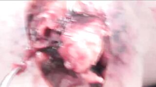 (DARK WEB) CHINESE DEAD WOMAN AUTOPSY