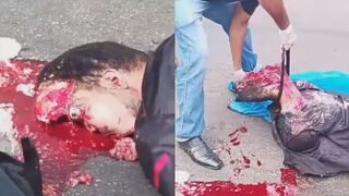 Truck Left Him Unrecognizable