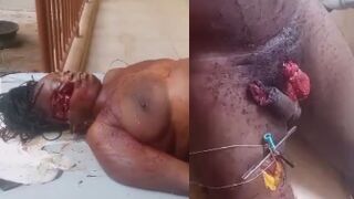 She Castrated Him Before He Killed Her And Himslef