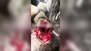Torn hand