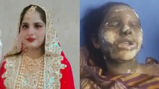 Woman  was doused with petrol & set on fire by her in-laws