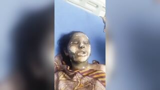 Woman  was doused with petrol & set on fire by her in-laws