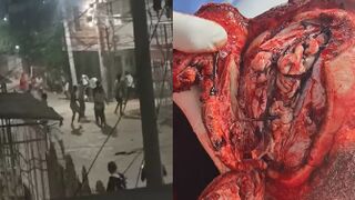 Man Hacked To Death By Machete gang