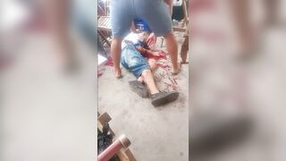 Drunk Dispute Leads to Being Hacked with a Machete