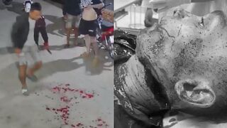 Man Dies After Getting Throat Slit During Street Fight