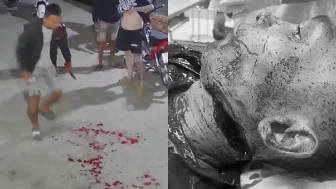 Man Dies After Getting Throat Slit During Street Fight