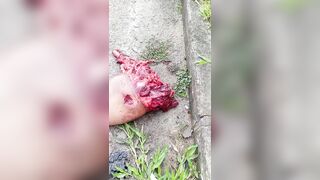 Man Completely Destroyed By Hit And Run Driver