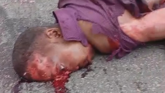 Man Completely Destroyed By Hit And Run Driver