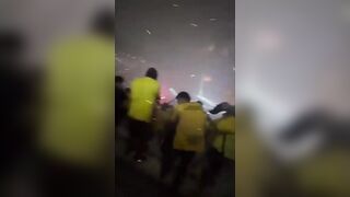 Woman Loses Finger After Firework Explosion