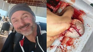 Italian Tourist Critically Injured By Boat Propeller In Colombia