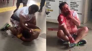Two Men Stab Each Other During Fight At The Bus Station