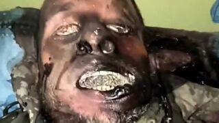 Ukrainian junkie with maggots.