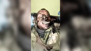 Ukrainian junkie with maggots.