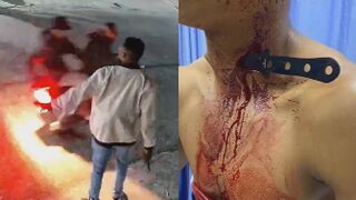 Robbery Victim Fights Back, Stabs Thief In The Neck