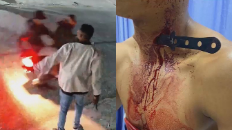 Robbery Victim Fights Back, Stabs Thief In The Neck