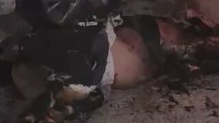 Terrible: Man Is Fully Awake With Amputated Limbs After Car Explosion In Israel