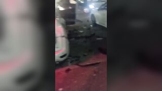 Terrible: Man Is Fully Awake With Amputated Limbs After Car Explosion In Israel
