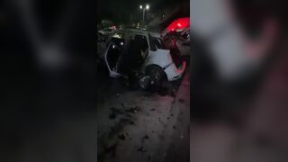 Terrible: Man Is Fully Awake With Amputated Limbs After Car Explosion In Israel