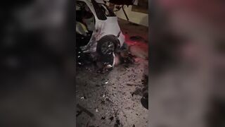 Terrible: Man Is Fully Awake With Amputated Limbs After Car Explosion In Israel