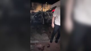 Terrible: Man Is Fully Awake With Amputated Limbs After Car Explosion In Israel
