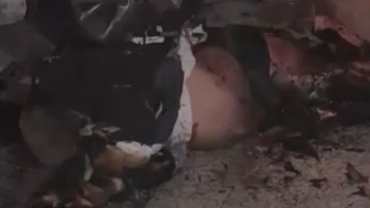 Terrible: Man Is Fully Awake With Amputated Limbs After Car Explosion In Israel