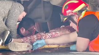 Woman loses leg in road accident