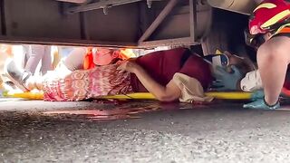 Woman loses leg in road accident