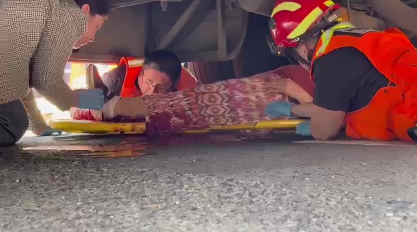 Woman loses leg in road accident