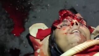 Female Protester Shot In The Head By Police During Riots In Iran