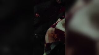 Female Protester Shot In The Head By Police During Riots In Iran