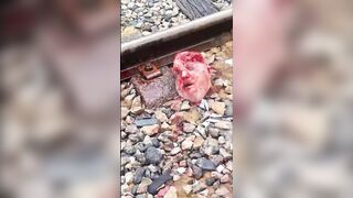 Train Accident Victim Lost His FACE
