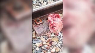 Train Accident Victim Lost His FACE