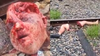 Train Accident Victim Lost His FACE